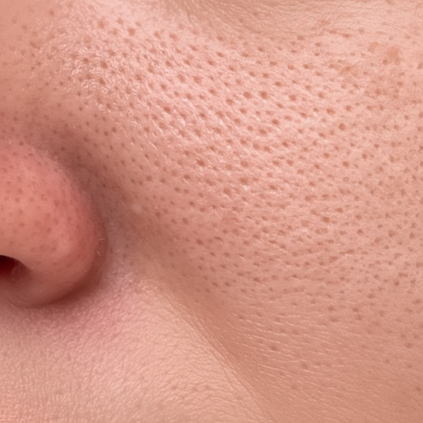 Large Pores - Reference Match